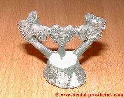 Metal base for bridge